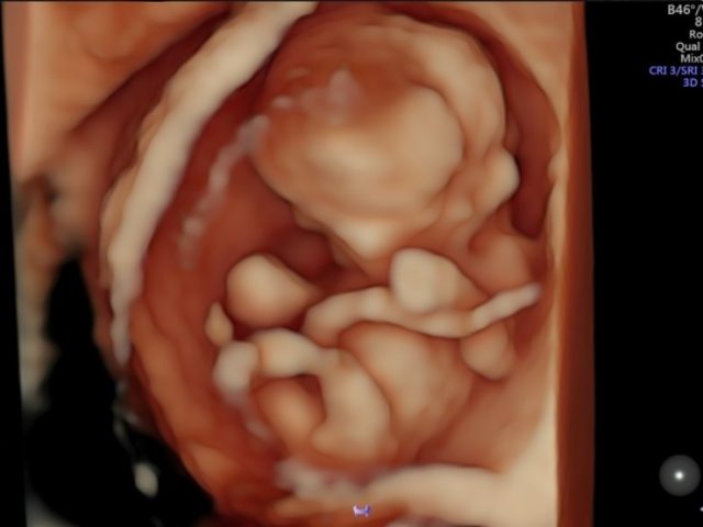 InkedInked12W 1 LI e1642403740157